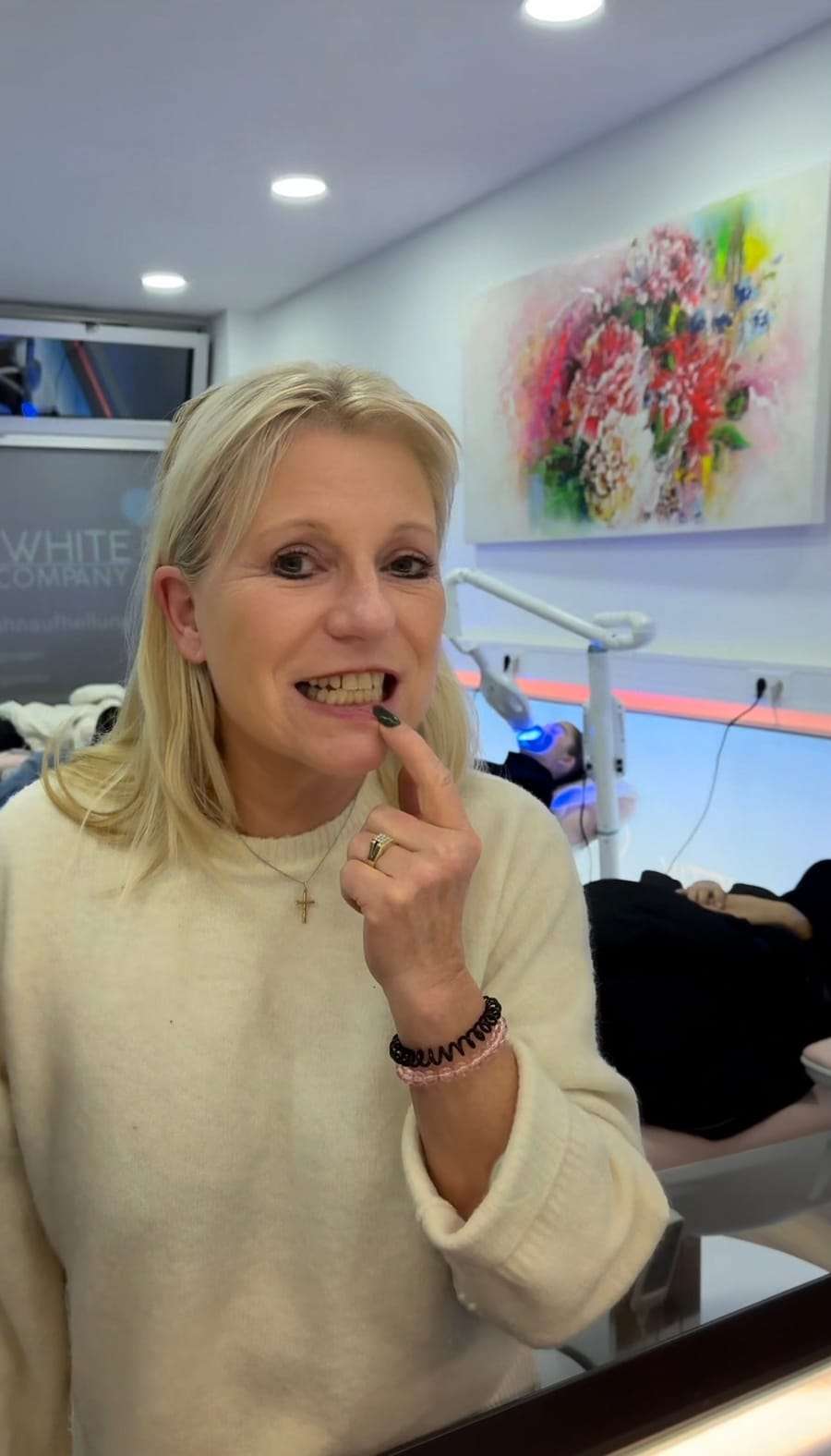 Kundin lächelt vor und nach der Bleaching-Behandlung im Studio