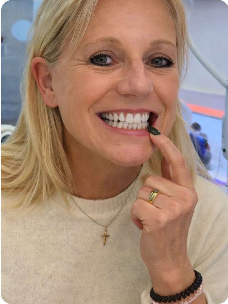 Echtes Kundenergebnis bei Dental White: Lächeln vor und nach dem Zahnbleaching