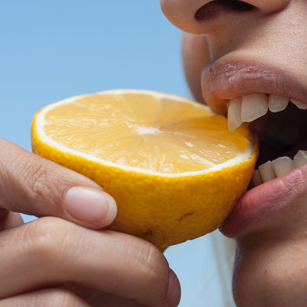 Strahlend weißes Lächeln nach Permanent Whitening Behandlung